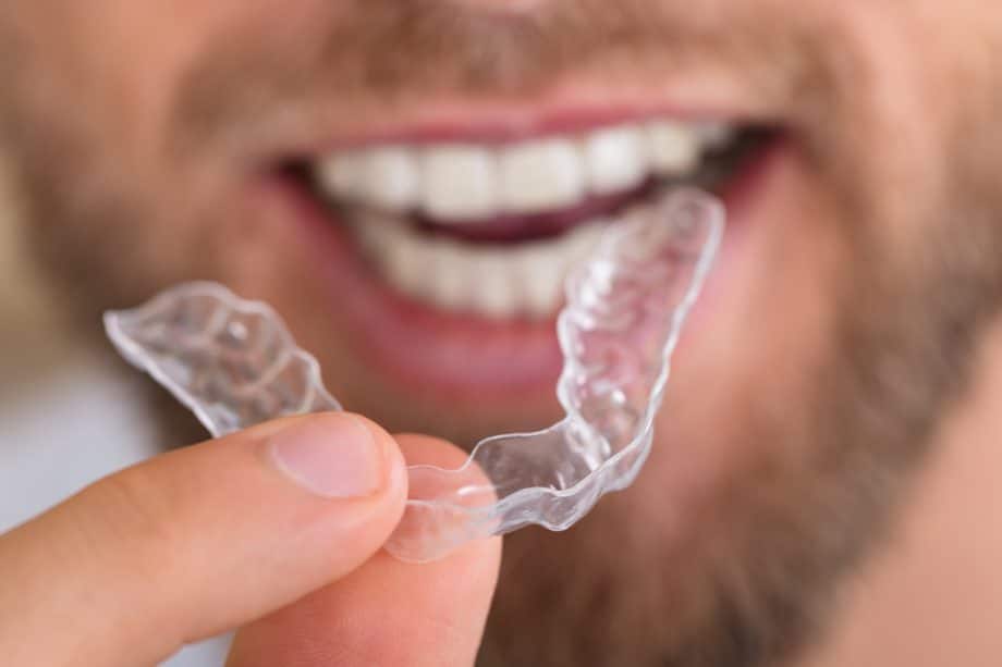 How Does Invisalign Work?